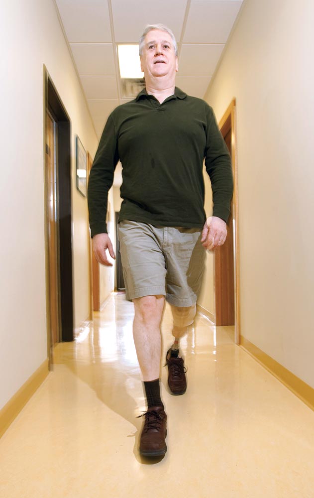 properly fit prosthesis allows the client to walk without looking to the ground